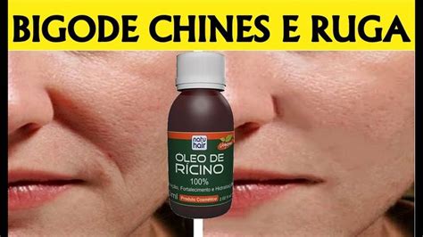 Óleo De Rícino Clareia A Pele - MISTUREI NO ÓLEO DE RÍCINO E CLAREOU MANCHAS E RUGAS, PUXOU PELE ...
