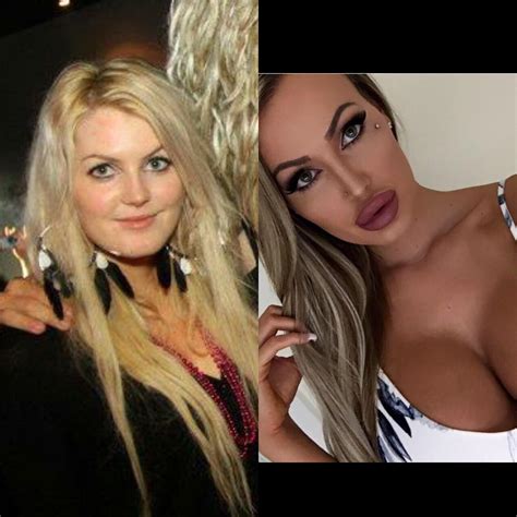 [X post r/awfuleverything] - Girl I went to school with. It's her in