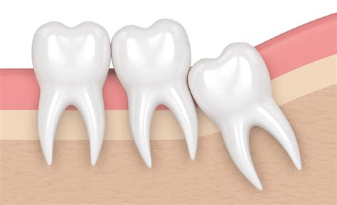 molars matter understanding  importance    teeth