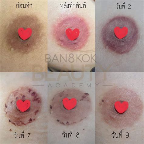 Why My Areola Is So Big: What’s Actually Normal and Why It Happens