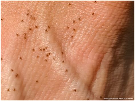 Seed tick larvae identification - wolfjumbo
