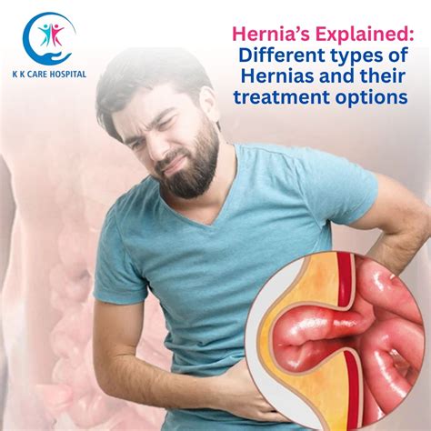 hernias explained types symptoms treatment options