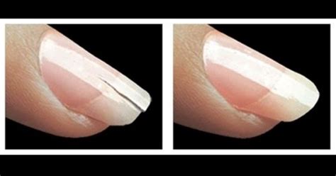 Unha Rachada No Meio O Que Fazer - Como Arranjar Uma Unha Rachada Em 2 Minutos!! | Healthy nails, No chip ...