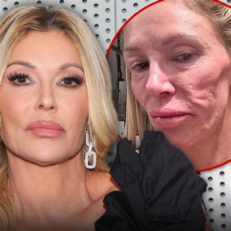 brandi glanville before 8