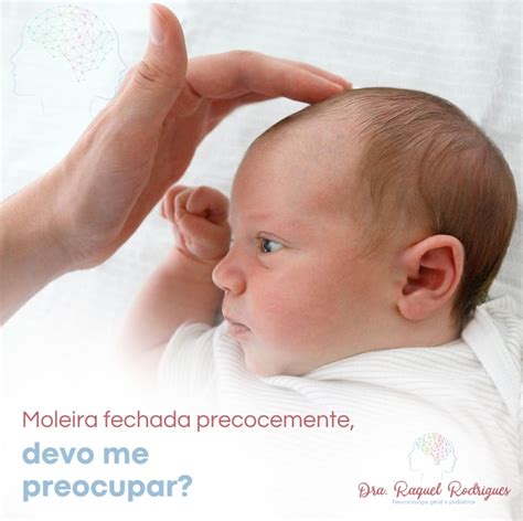 Quanto Tempo A Moleira Fecha - Moleira fechada precocemente - devo me preocupar? - Dra. Raquel ...