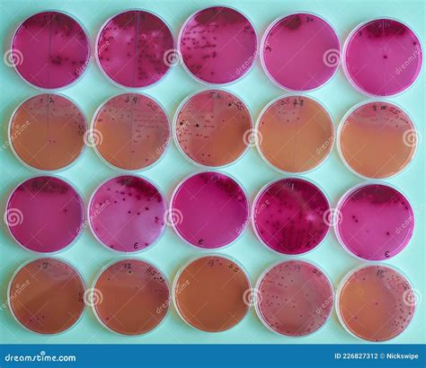 Agar Plates with Bacteria Colonies in Various Petri Dish Stock Photo ...