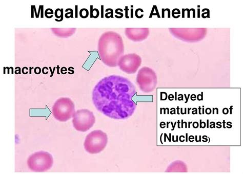 mch blood test normal range   high mch