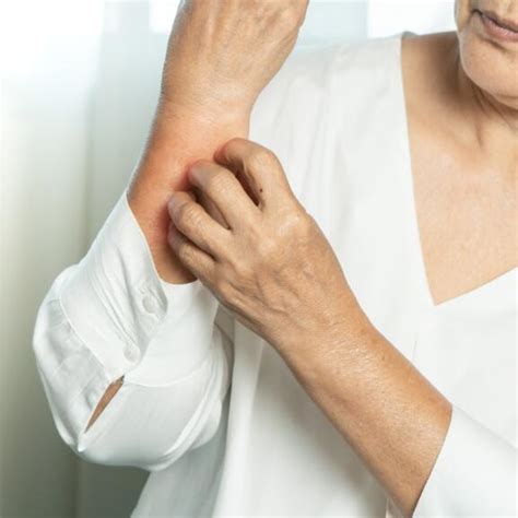 aliviar los picores despues de la ducha  derma