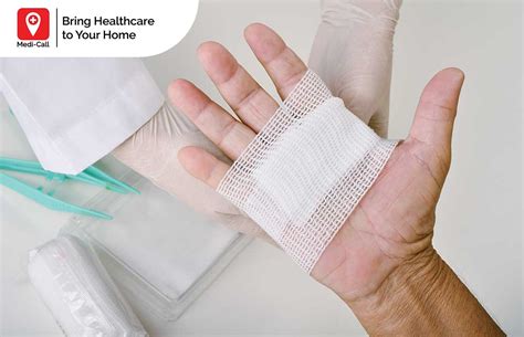 modern dressing luka bakar bantu luka bakar jadi cepat sembuh
