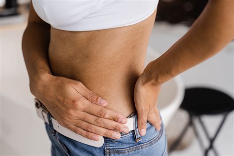 Hernia | lekar.sk