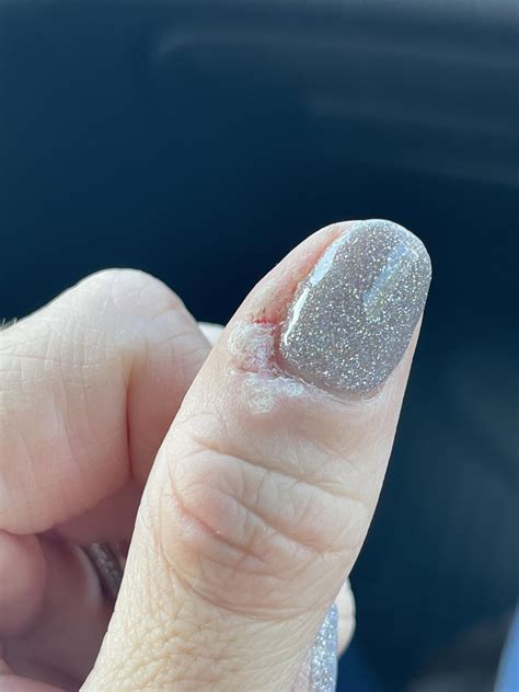 cuticle    comments rnails