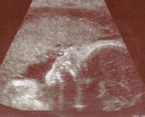 30 weeks pregnant 4d ultrasound - hisasweb