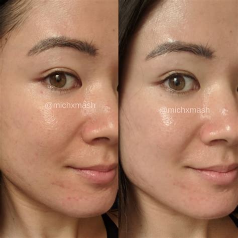 いろいろ vitamin c serum before and after photos 109717-Vitamin c serum ...