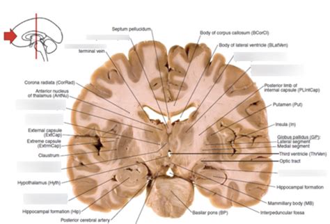 coronal cross section of brain 4 Diagram | Brain anatomy and function