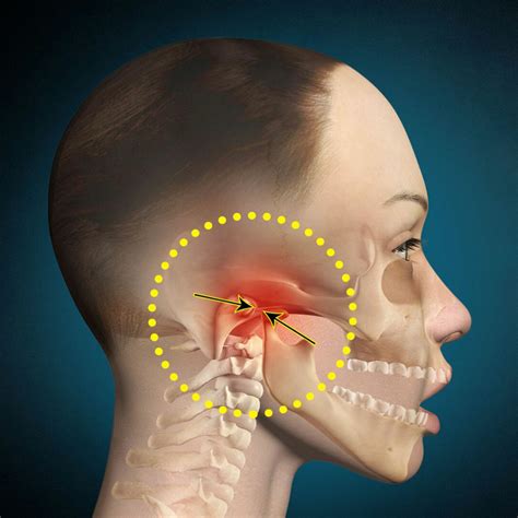 Especialistas Em Disfunção Temporomandibular E Dor Orofacial - Especialista em DTM e Dor Orofacial - Dr. Rafael Tardin