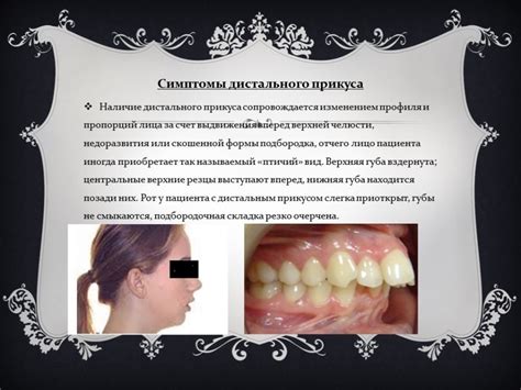 Дистальный прикус - Стоматология Набережные Челны - DENTAL FORTE ...
