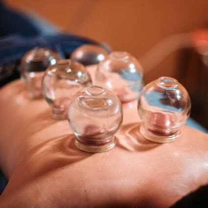 cupping brantford   body health
