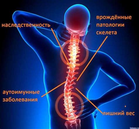 Защемление нерва в грудной клетке лечение – как лечить, первая помощь ...