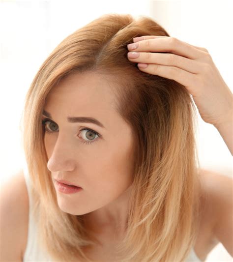 Lupus Hair Loss: Causes, Types, And Treatment