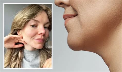 rid   double chin  face yoga exercises  improve