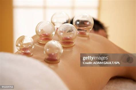 cupping therapy stock  high res pictures  images