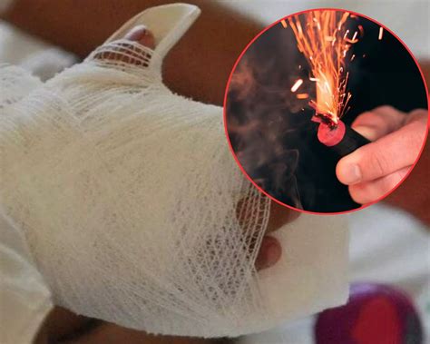 ¡Comenzó diciembre y ya hay quemados! Primer caso en Santa Marta que