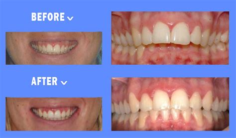 braces orthodontist specialist