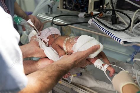 Myelomeningocele birth defect - Stock Image - C018/0408 - Science Photo ...