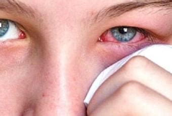 Pink Eye Causes and Effective Treatment Options - Paperblog