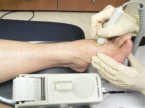 Why Seeing a Podiatrist Could Save Your Feet (And Your Life