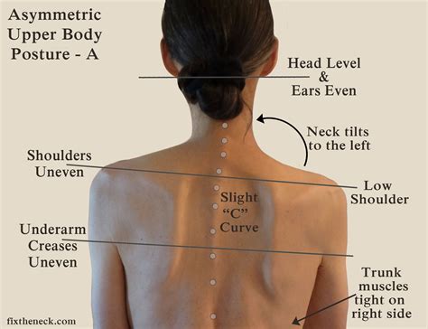 Asymmetric upper body posture – Artofit