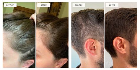 how to delay grey hair