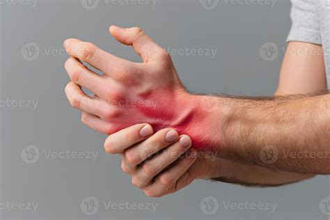 A person experiences significant pain with a red, swollen hand and