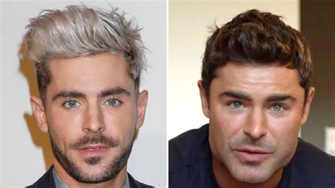 Zac Efron Transformation: Actor Revealed What Really Happened to His ...