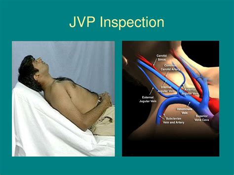 PPT - Jugular Venous Pulse PowerPoint Presentation, free download - ID ...