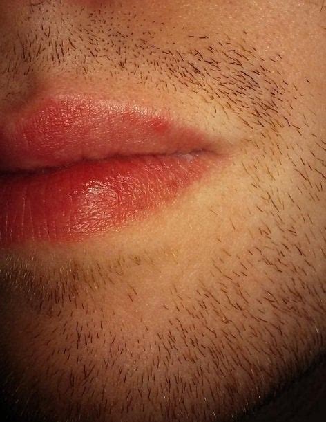 [Skin Concerns]Red circle on same spot of lip every morning ...