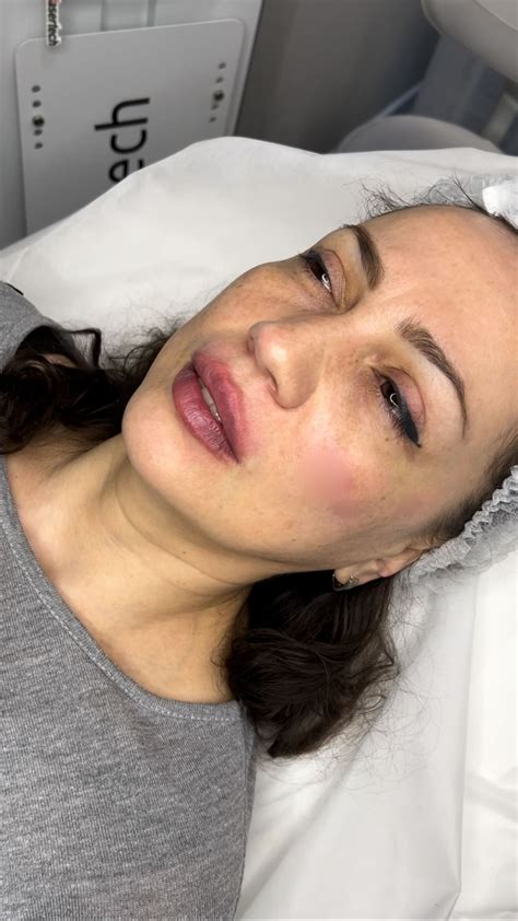 КОСМЕТОЛОГ Чебоксары Виктория | Обучение (@kabetova_cosmetolog ...