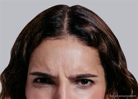 rid  jowls realself news