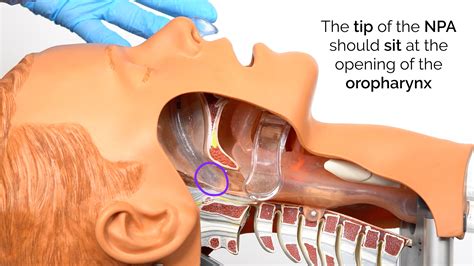 Nasopharyngeal Airway Anatomy