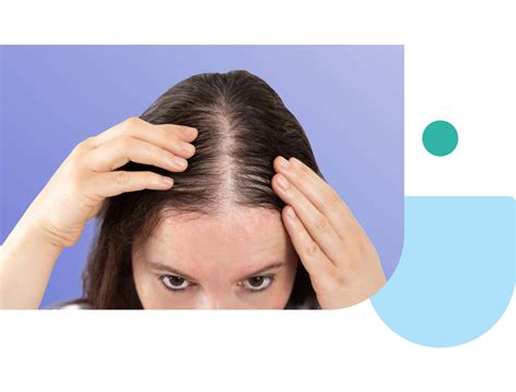 spironolactone hair growth 11