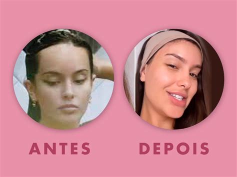 Como Diminuir A Testa