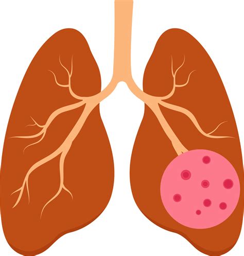 Lung Cancer Color