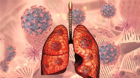 lesser  signs  lung cancer onlymyhealth