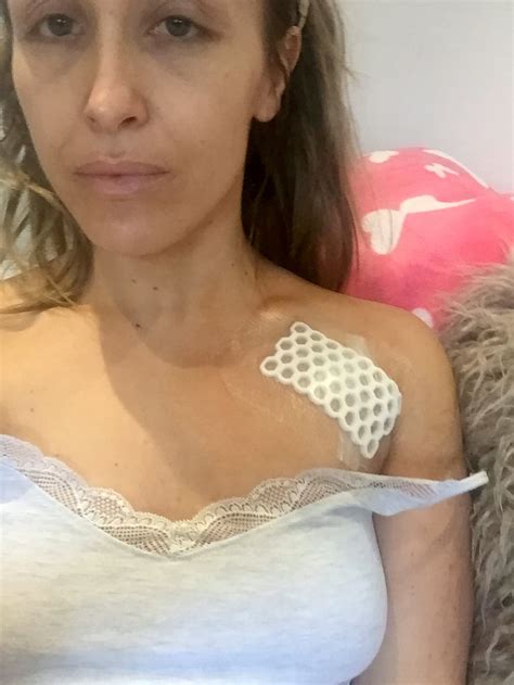 My palpitations were dismissed as anxiety — turns out I have a deadly
