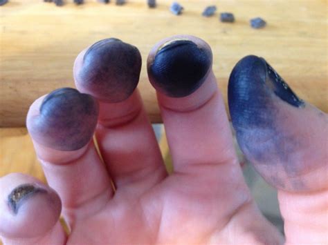 How to get ink off skin — How to remove ink from skin | by mohd faizan