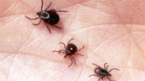 What are Heartland virus symptoms? And how do you remove a tick?