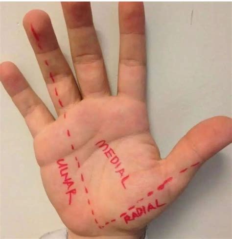 Nerves Of The Hand - MEDizzy