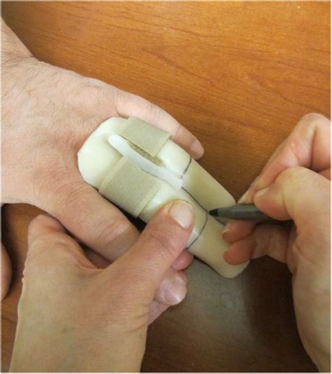 Proximal Interphalangeal Joint Extension Block Splint Jack, 48% OFF