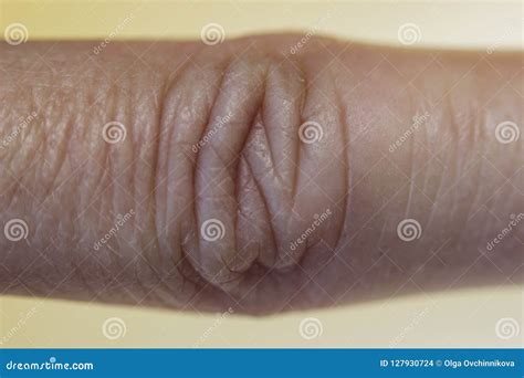 The Finger Joint of the Female with Skin Folds, Macro Photo. Stock ...