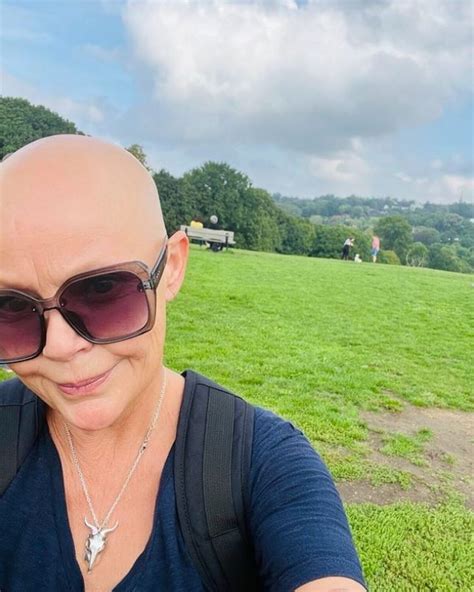 Scots TV host Gail Porter told she could be "pretty again" if she wore